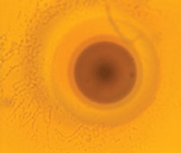 A fully developed polonium-218 radiohalo three rings clearly visible.